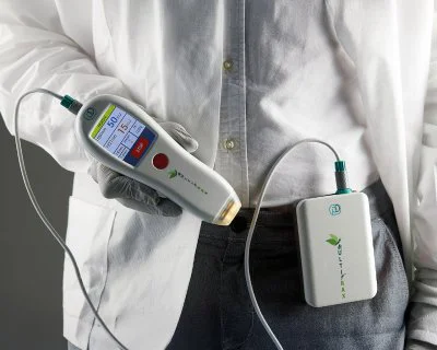 MultiFrax Portable Fractional Laser Machine | Skin Resurfacing