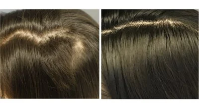 derive-before-and-after-2.webp